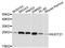 Nudix Hydrolase 21 antibody, STJ24845, St John