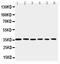 PDZ Binding Kinase antibody, PA2305, Boster Biological Technology, Western Blot image 
