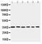 PBK/TOPK antibody, PA2305, Boster Biological Technology, Western Blot image 