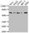 Histone Deacetylase 2 antibody, CSB-RA593846A0HU, Cusabio, Western Blot image 