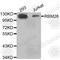 RNA Binding Motif Protein 26 antibody, A5997, ABclonal Technology, Western Blot image 