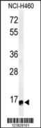 Ribosomal Protein S13 antibody, MBS9208067, MyBioSource, Western Blot image 