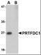Phosphoribosyl Transferase Domain Containing 1 antibody, orb89166, Biorbyt, Western Blot image 
