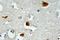 Insulin Receptor Substrate 1 antibody, LS-C178019, Lifespan Biosciences, Immunohistochemistry frozen image 