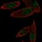 Gem Nuclear Organelle Associated Protein 6 antibody, PA5-65157, Invitrogen Antibodies, Immunofluorescence image 