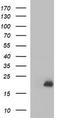 Group XVI phospholipase A2 antibody, TA506967S, Origene, Western Blot image 