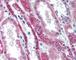 TNF Receptor Superfamily Member 11a antibody, 49-328, ProSci, Immunohistochemistry paraffin image 