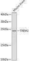 Triggering Receptor Expressed On Myeloid Cells 2 antibody, 13-679, ProSci, Western Blot image 