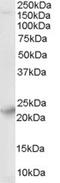 Synaptogyrin 4 antibody, EB06586, Everest Biotech, Western Blot image 
