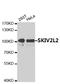 Mtr4 Exosome RNA Helicase antibody, A32485, Boster Biological Technology, Western Blot image 