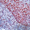 E2F-1 antibody, LS-C88542, Lifespan Biosciences, Immunohistochemistry paraffin image 