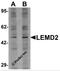 LEM Domain Containing 2 antibody, 6891, ProSci, Western Blot image 