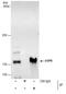 Ubiquitin Specific Peptidase 8 antibody, PA5-27947, Invitrogen Antibodies, Immunoprecipitation image 