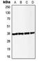 Linker For Activation Of T Cells antibody, MBS822203, MyBioSource, Western Blot image 
