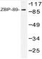 Zinc Finger Protein 148 antibody, AP20538PU-N, Origene, Western Blot image 