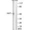 Histone Acetyltransferase 1 antibody, PA5-49753, Invitrogen Antibodies, Western Blot image 