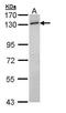 E3 ubiquitin-protein ligase BRE1A antibody, GTX109026, GeneTex, Western Blot image 