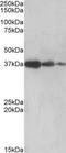 Protein Phosphatase 2 Phosphatase Activator antibody, NBP1-51951, Novus Biologicals, Western Blot image 
