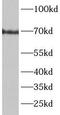 Cathepsin C antibody, FNab09934, FineTest, Western Blot image 