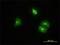 Clathrin Light Chain B antibody, H00001212-M01, Novus Biologicals, Immunocytochemistry image 