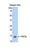 Collagen Type II Alpha 1 Chain antibody, LS-C373102, Lifespan Biosciences, Western Blot image 