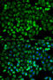 TPS1 antibody, STJ25946, St John