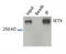 Senataxin antibody, TA309853, Origene, Western Blot image 