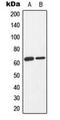 Protein Kinase AMP-Activated Catalytic Subunit Alpha 1 antibody, MBS8240942, MyBioSource, Western Blot image 