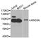 AT-Rich Interaction Domain 3A antibody, STJ29981, St John