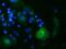 Oxysterol Binding Protein Like 11 antibody, GTX83963, GeneTex, Immunocytochemistry image 