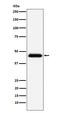CD48 Molecule antibody, M03281, Boster Biological Technology, Western Blot image 