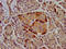 Colipase antibody, LS-C669906, Lifespan Biosciences, Immunohistochemistry paraffin image 