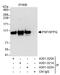 Splicing Factor Proline And Glutamine Rich antibody, A301-321A, Bethyl Labs, Immunoprecipitation image 