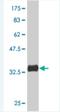 P21 (RAC1) Activated Kinase 4 antibody, H00010298-M01, Novus Biologicals, Western Blot image 