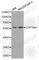 Cytochrome P450 Family 19 Subfamily A Member 1 antibody, A1336, ABclonal Technology, Western Blot image 