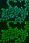 ATP Synthase Peripheral Stalk Subunit OSCP antibody, GTX65873, GeneTex, Immunofluorescence image 