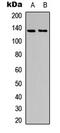 ACK1 antibody, abx121788, Abbexa, Western Blot image 