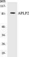 Amyloid Beta Precursor Like Protein 2 antibody, EKC1035, Boster Biological Technology, Western Blot image 