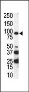 Tyrosine-protein kinase receptor UFO antibody, AP14269PU-N, Origene, Western Blot image 