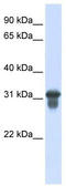 Solute Carrier Family 25 Member 11 antibody, TA333994, Origene, Western Blot image 