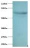 Actin Related Protein 2/3 Complex Subunit 3 antibody, LS-C211596, Lifespan Biosciences, Western Blot image 