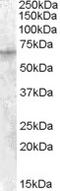 Potassium Voltage-Gated Channel Subfamily J Member 11 antibody, orb19764, Biorbyt, Western Blot image 