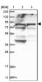 Acyl-CoA Oxidase 3, Pristanoyl antibody, NBP1-85900, Novus Biologicals, Western Blot image 