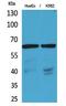 Organic anion transporter 1 antibody, STJ96749, St John