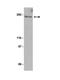Fms Related Tyrosine Kinase 1 antibody, LS-B8712, Lifespan Biosciences, Western Blot image 