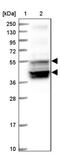 Putative sodium-coupled neutral amino acid transporter 7 antibody, PA5-59723, Invitrogen Antibodies, Western Blot image 