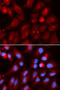 Proteasome Subunit Beta 2 antibody, A07697, Boster Biological Technology, Western Blot image 