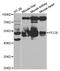 Propionyl-CoA Carboxylase Subunit Beta antibody, A5415, ABclonal Technology, Western Blot image 