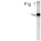 Tafazzin antibody, PA1-4218, Invitrogen Antibodies, Western Blot image 