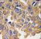 AKT Serine/Threonine Kinase 2 antibody, LS-C98942, Lifespan Biosciences, Immunohistochemistry paraffin image 